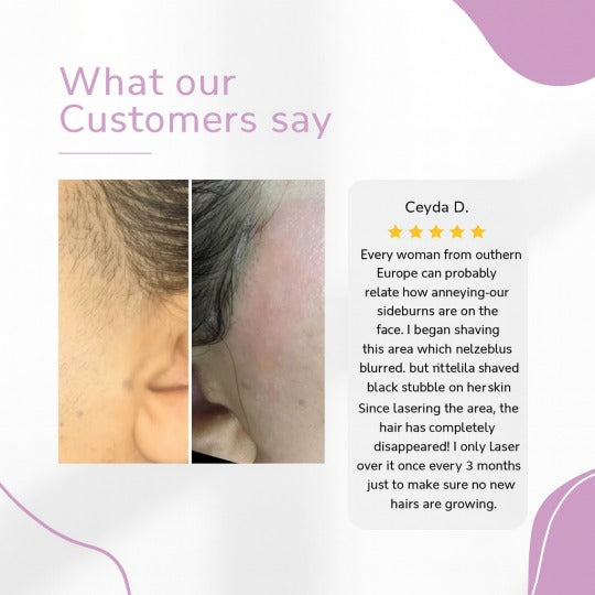 „Ylvis IPL“ plaukų šalinimo prietaisas – lygi, be plaukų oda namuose